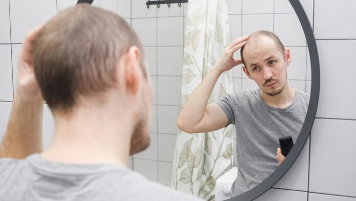 Cure for male pattern baldness could be in sugar found in human body: study