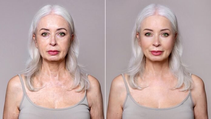 Dr. Terry Dubrow says facelift timing can make or break your results